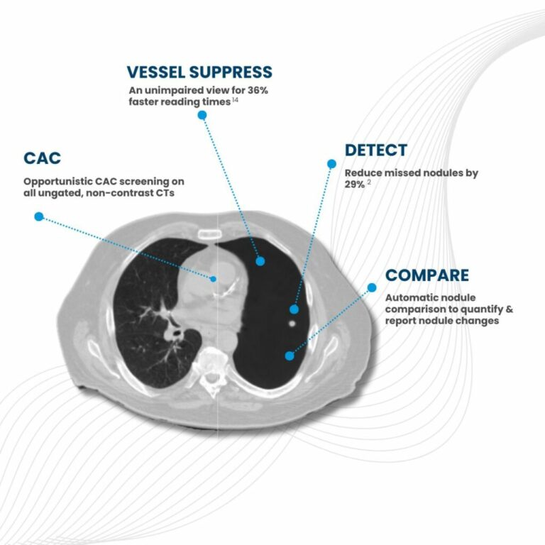 ClearRead CT