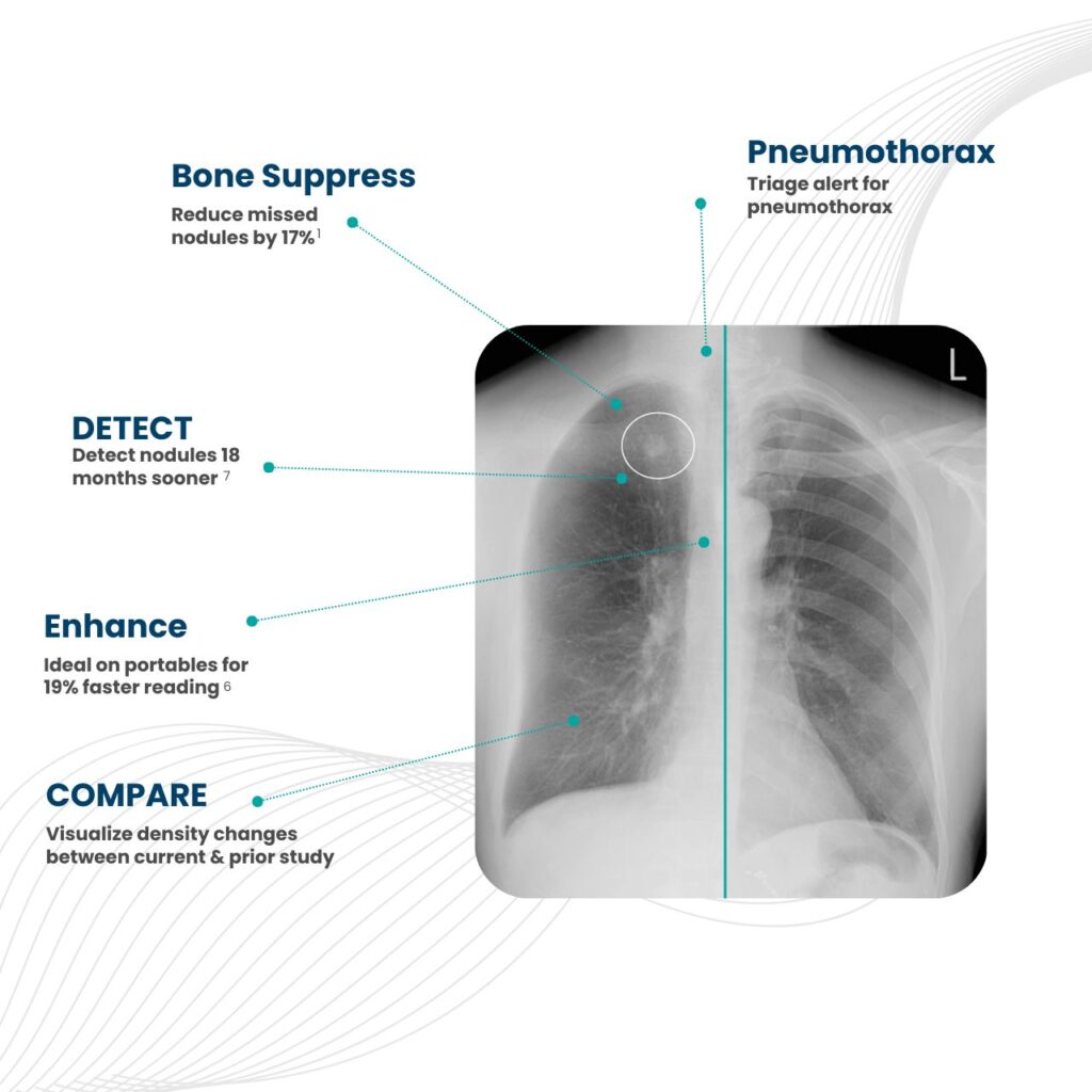 ClearRead Xray